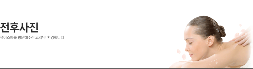 전후사진 -퓨어스파를 방문해주신 고객님! 환영합니다.